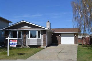 Photo 1: 220 DUNLUCE RD NW: Edmonton House for sale : MLS®# E4054042
