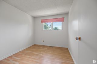 Photo 16: 260 KNOTTWOOD Road in Edmonton: Zone 29 House for sale : MLS®# E4321093