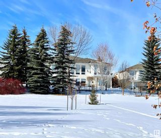 Photo 33: 317 TORY View in Edmonton: Zone 14 House Half Duplex for sale : MLS®# E4331654