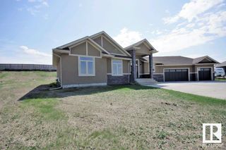Photo 29: 26107 Twp 532A Road: Rural Parkland County House for sale : MLS®# E4378330