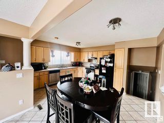 Photo 6: 11441 162A Avenue in Edmonton: Zone 27 House for sale : MLS®# E4385938