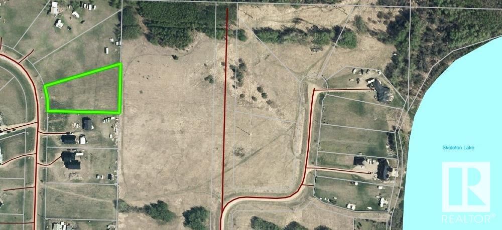 Main Photo: 5 Deer Run Est, SKELETON LAKE: Rural Athabasca County Vacant Lot/Land for sale : MLS®# E4327820