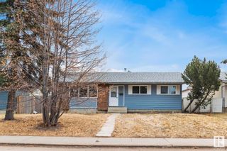 Photo 1: 363 knottwood Road W in Edmonton: Zone 29 House for sale : MLS®# E4380646