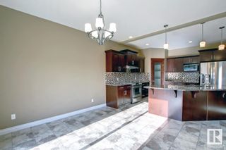 Photo 11: 15151 32 Street in Edmonton: Zone 35 House for sale : MLS®# E4292664