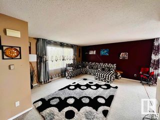 Photo 3: 11441 162A Avenue in Edmonton: Zone 27 House for sale : MLS®# E4385938