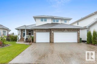 Photo 2: 10303 175 Avenue in Edmonton: Zone 27 House for sale : MLS®# E4392806