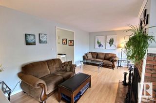Photo 11: 415 DUNLUCE Road in Edmonton: Zone 27 Townhouse for sale : MLS®# E4305422