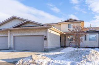 Photo 1: 155 KNOTTWOOD Road N in Edmonton: Zone 29 House Half Duplex for sale : MLS®# E4331786