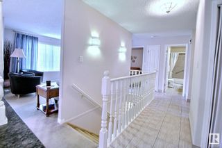 Photo 12: 967 Youville Drive in Edmonton: Zone 29 Townhouse for sale : MLS®# E4370763