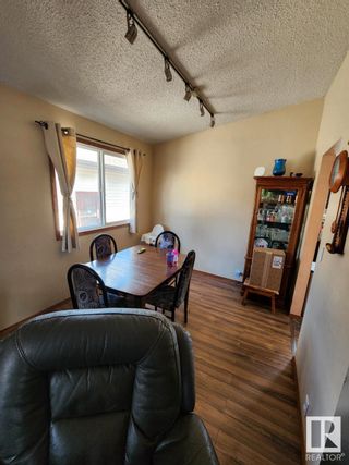 Photo 9: 772 Warwick Road in Edmonton: Zone 27 House for sale : MLS®# E4291332