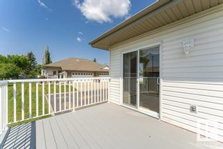 Photo 34: 5 17603 99 Street in Edmonton: Zone 27 House Half Duplex for sale : MLS®# E4356558