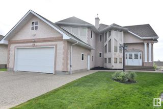 Photo 1: 16115 57 Street in Edmonton: Zone 03 House for sale : MLS®# E4384809
