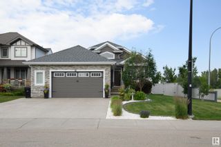 Photo 4: 1 LINCOLN Gate: Spruce Grove House for sale : MLS®# E4386182