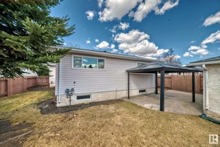 Photo 32: 14215 74 Street in Edmonton: Zone 02 House for sale : MLS®# E4381528