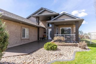 Photo 3: 16206 1A Street NE in Edmonton: Zone 51 House for sale : MLS®# E4376416