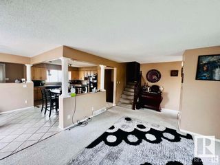 Photo 5: 11441 162A Avenue in Edmonton: Zone 27 House for sale : MLS®# E4385938