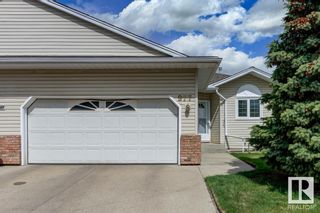 Photo 2: 977 YOUVILLE Drive W in Edmonton: Zone 29 House Half Duplex for sale : MLS®# E4339814