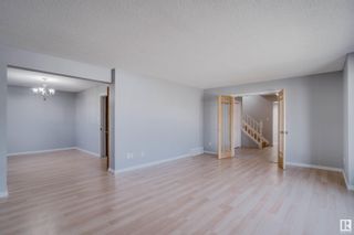 Photo 6: 15447 103 Street in Edmonton: Zone 27 House for sale : MLS®# E4314173