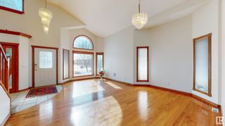 Photo 2: 175 HERITAGE Drive: St. Albert House for sale : MLS®# E4331109