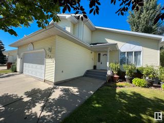 Photo 2: 10208 174 Avenue in Edmonton: Zone 27 House for sale : MLS®# E4310171