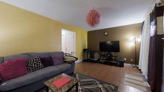 Photo 15: 924 LAKEWOOD Road in Edmonton: Zone 29 Townhouse for sale : MLS®# E4273268
