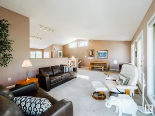 Photo 14: 9516 99A Street in Edmonton: Zone 15 House for sale : MLS®# E4357884