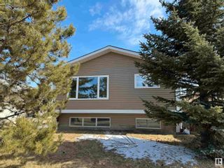 Photo 1: 1566 LAKEWOOD Road in Edmonton: Zone 29 House for sale : MLS®# E4382514