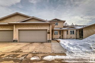 Photo 44: 147 KNOTTWOOD Road N in Edmonton: Zone 29 Townhouse for sale : MLS®# E4373827