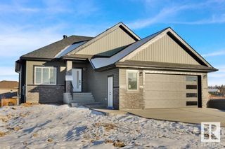 Photo 1: 712 166 Avenue NE in Edmonton: Zone 51 House for sale : MLS®# E4374131
