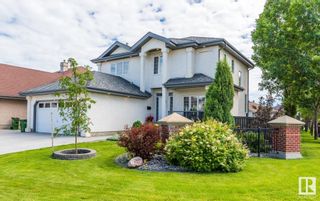 Photo 1: 15503 135 Street in Edmonton: Zone 27 House for sale : MLS®# E4309585