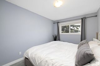 Photo 17: 8621 MILL WOODS Road in Edmonton: Zone 29 Townhouse for sale : MLS®# E4389042