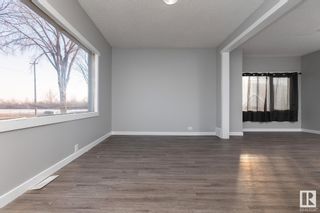 Photo 9: 12760 113A Street in Edmonton: Zone 01 House for sale : MLS®# E4372588