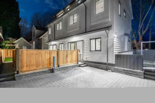 Photo 25: 2850 MACKENZIE Street in Vancouver: Kitsilano 1/2 Duplex for sale (Vancouver West)  : MLS®# R2874854