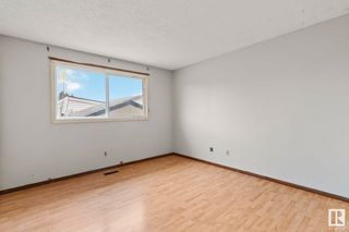 Photo 30: 363 knottwood Road W in Edmonton: Zone 29 House for sale : MLS®# E4380646