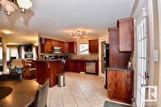 Photo 9: 6512 106 Street in Edmonton: Zone 15 House Half Duplex for sale : MLS®# E4355517