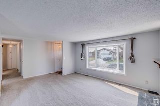 Photo 6: 15235 118 Street in Edmonton: Zone 27 House for sale : MLS®# E4358466
