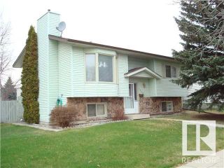 Photo 2: 17404 95 Street in Edmonton: Zone 28 House for sale : MLS®# E4329688