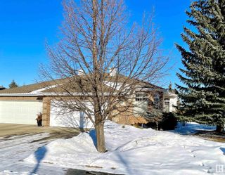 Photo 1: 317 TORY View in Edmonton: Zone 14 House Half Duplex for sale : MLS®# E4331654
