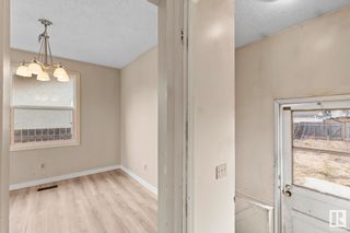 Photo 15: 363 knottwood Road W in Edmonton: Zone 29 House for sale : MLS®# E4380646