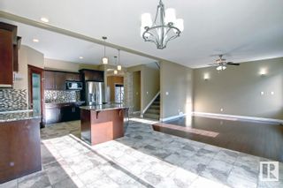 Photo 10: 15151 32 Street in Edmonton: Zone 35 House for sale : MLS®# E4292664