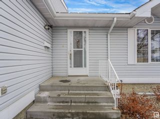 Photo 53: 5 13217 155 Avenue in Edmonton: Zone 27 House Half Duplex for sale : MLS®# E4382159