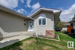Photo 35: 977 YOUVILLE Drive W in Edmonton: Zone 29 House Half Duplex for sale : MLS®# E4339814