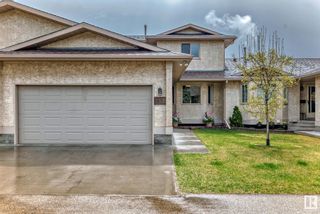 Main Photo: 155 KNOTTWOOD Road N in Edmonton: Zone 29 Townhouse for sale : MLS®# E4387734