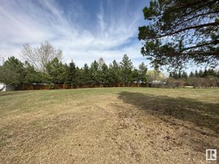 Photo 9: 8 26413 TWP RD 510: Rural Parkland County Vacant Lot/Land for sale : MLS®# E4384433