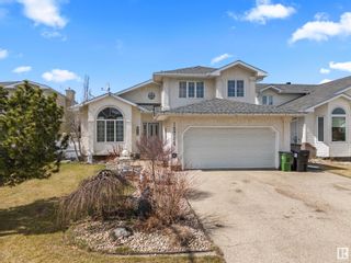 Photo 1: 15716 68 Street in Edmonton: Zone 28 House for sale : MLS®# E4384789