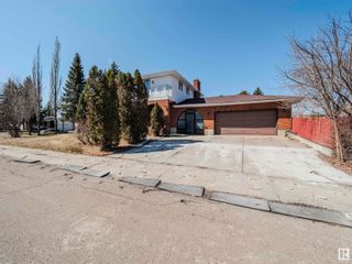 Photo 6: 17104 111 Street in Edmonton: Zone 27 House for sale : MLS®# E4383911