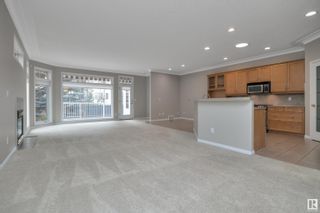 Photo 6: 316 TORY View in Edmonton: Zone 14 House Half Duplex for sale : MLS®# E4382266